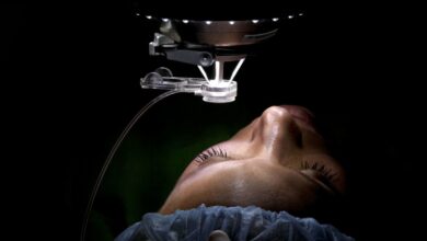 Photo of How Does Lasik Work