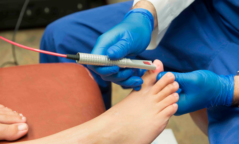 Nail Fungal