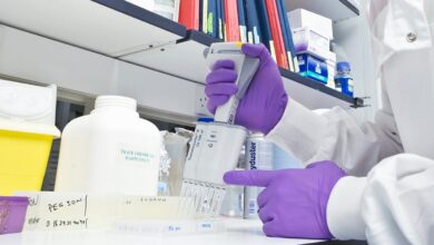 Photo of The Importance Of Finding A Reliable Source For Immunoassay Reagents