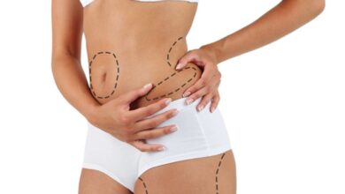 Photo of A Guide To Learn About The Liposuction Treatment