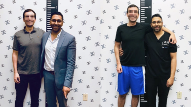 Photo of More Young Men Are Resorting to Limb Lengthening Surgery to Grow Taller