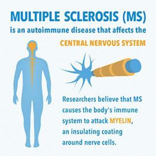WHAT YOU MUST KNOW ABOUT MS STEM CELL RESEARCH