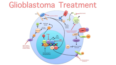 Photo of Glioblastoma Treatment