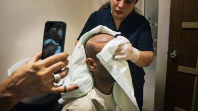 Photo of Is it safe to get a hair transplant in Turkey?
