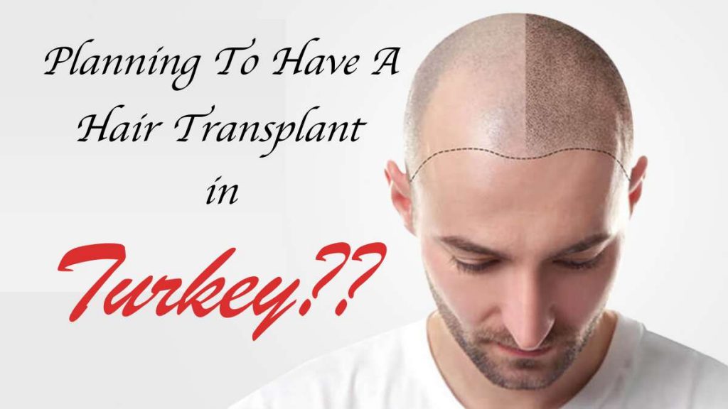 Are You Planning To Have A Hair Transplant In Turkey?