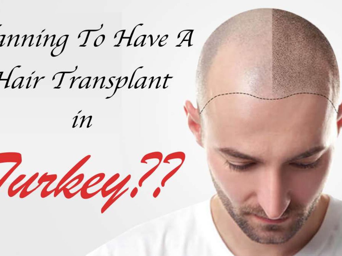 Are You Planning To Have A Hair Transplant In Turkey 01