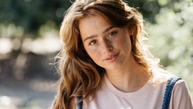 Photo of Ultimate guide to treat acne