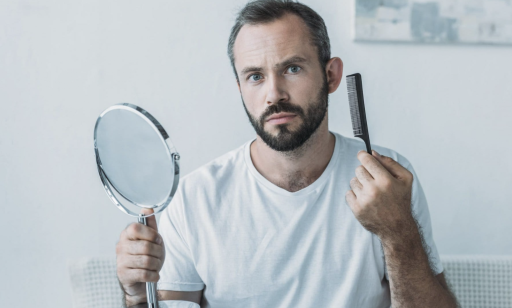 3 Signs of Balding and Effective Treatments
