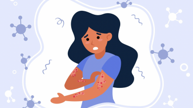 Photo of Effective Ayurveda Treatment for Skin Allergies