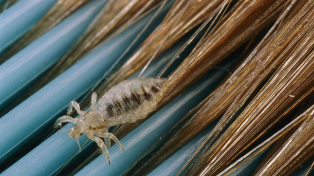 Steps to Controlling a Lice Outbreak at Home