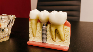 Photo of Are Dental Implants the Right Option for You?