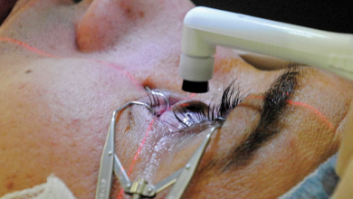 Photo of How to Take Care of Yourself After Cataract Surgery