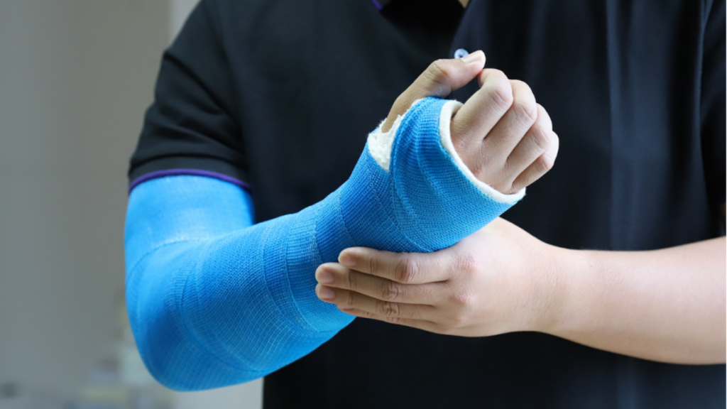 A Quick Guide To Sugar Tong Splinting IMC Grupo