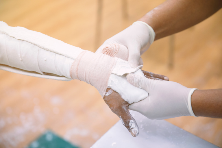 A Quick Guide To Sugar Tong Splinting IMC Grupo