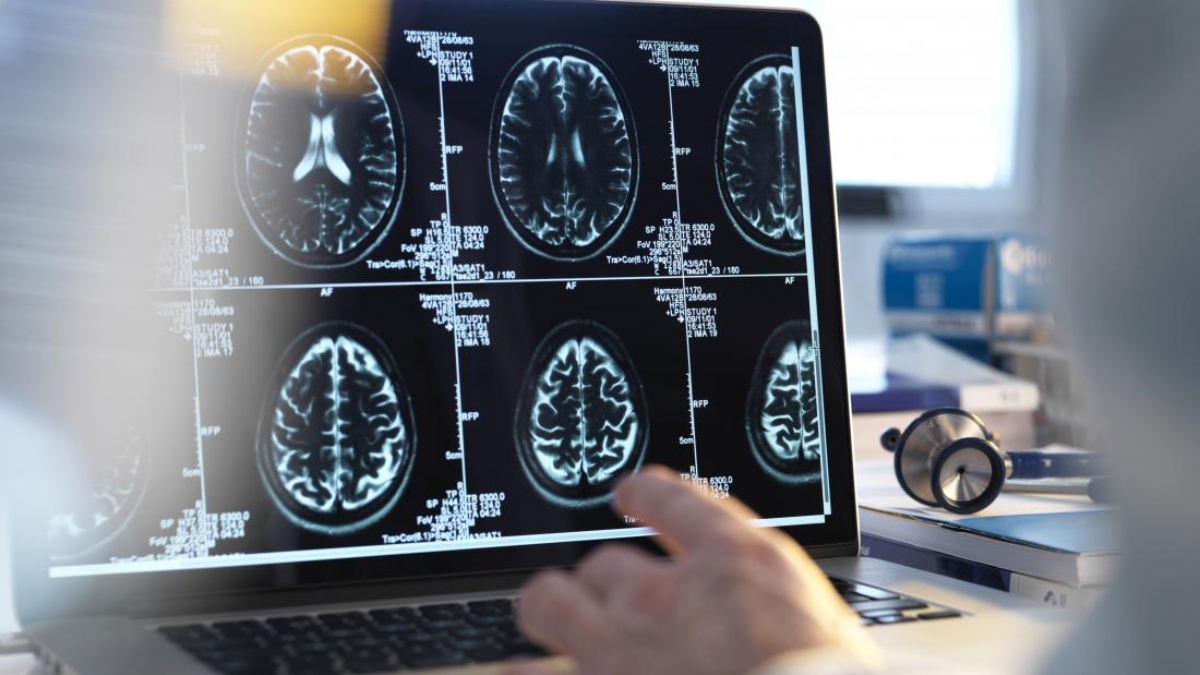 Know About The Problems And Solutions Of Encephalopathy