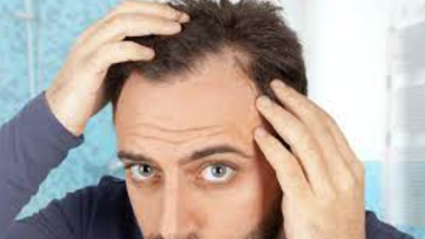 Photo of How does a beard transplant work