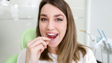 Photo of Advantages of Clear Aligners Over Braces