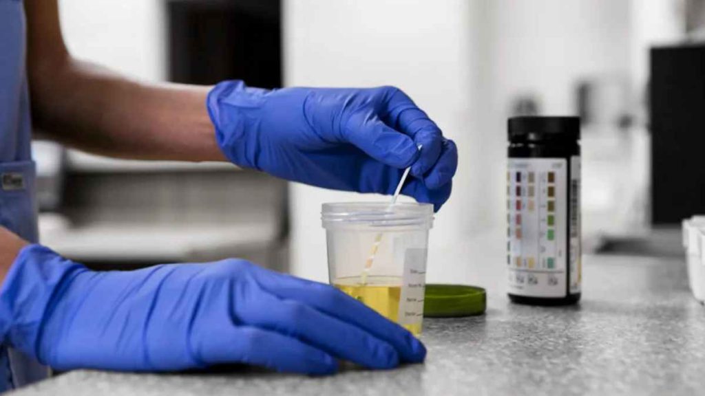 How To Use Home Drug Test Kit Step-by-step Instruction