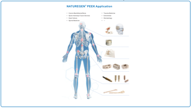 Photo of A Quick Peek at PEEK: What Makes PEEK Rod the Best Medical Implant?