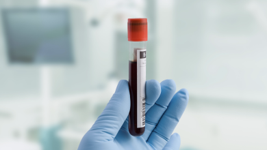 Photo of DNA Diagnostic Kits: What You Need To Know Before Buying