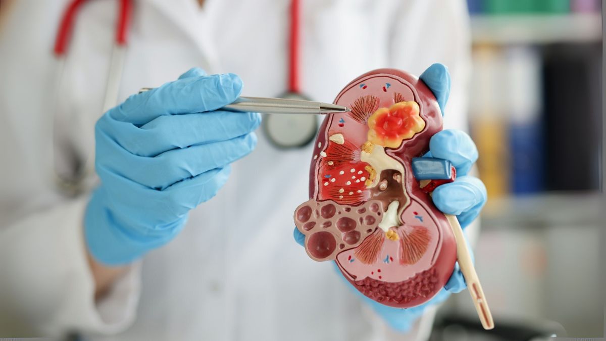 Driehaus Capital, Rock Springs Capital, and Armistice Capital Increase Positions in Travere’s Rare Kidney Disease Therapeutics