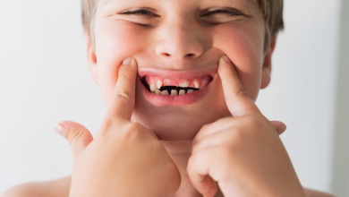 Photo of Jonathan Alexander Abt: Understanding Hypodontia