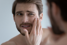 Photo of When Sensitive Skin Makes Standard Rosacea Treatments Hard to Use