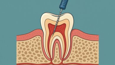 Photo of Root Canal Treatment Explained: What Patients Should Know Before Their Appointment